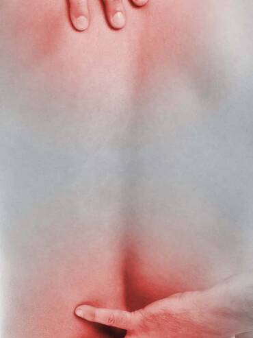 Fisioterapista-Villafranca-Maraia-Sciatica-1_web